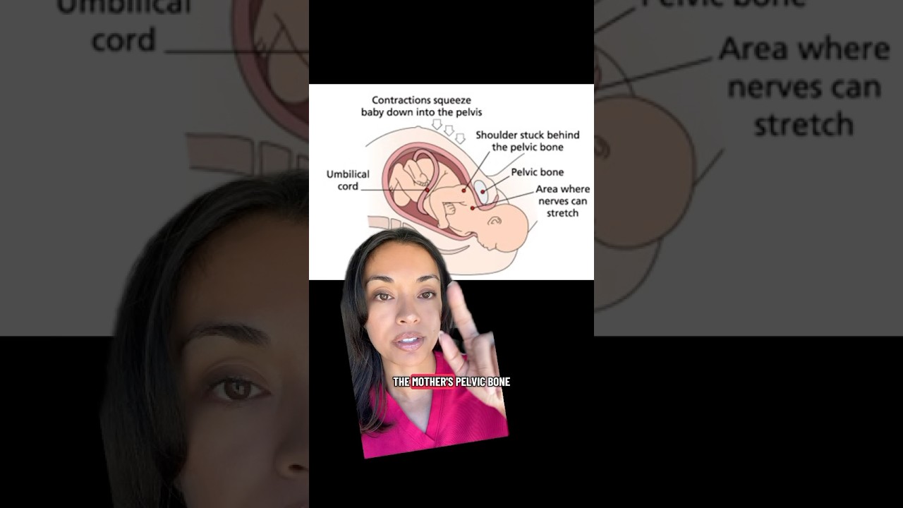 Let&rsquo;s talk about Shoulder Dystocia.