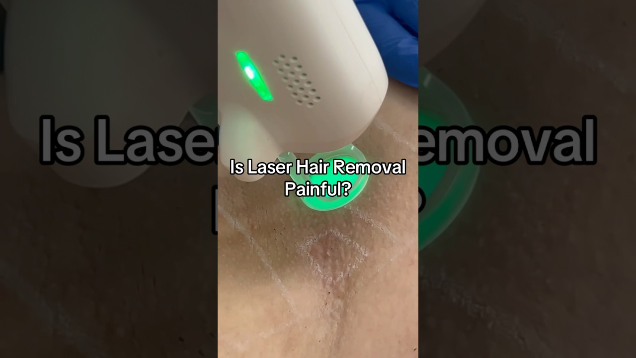 Is Laser Hair Removal Painful? 