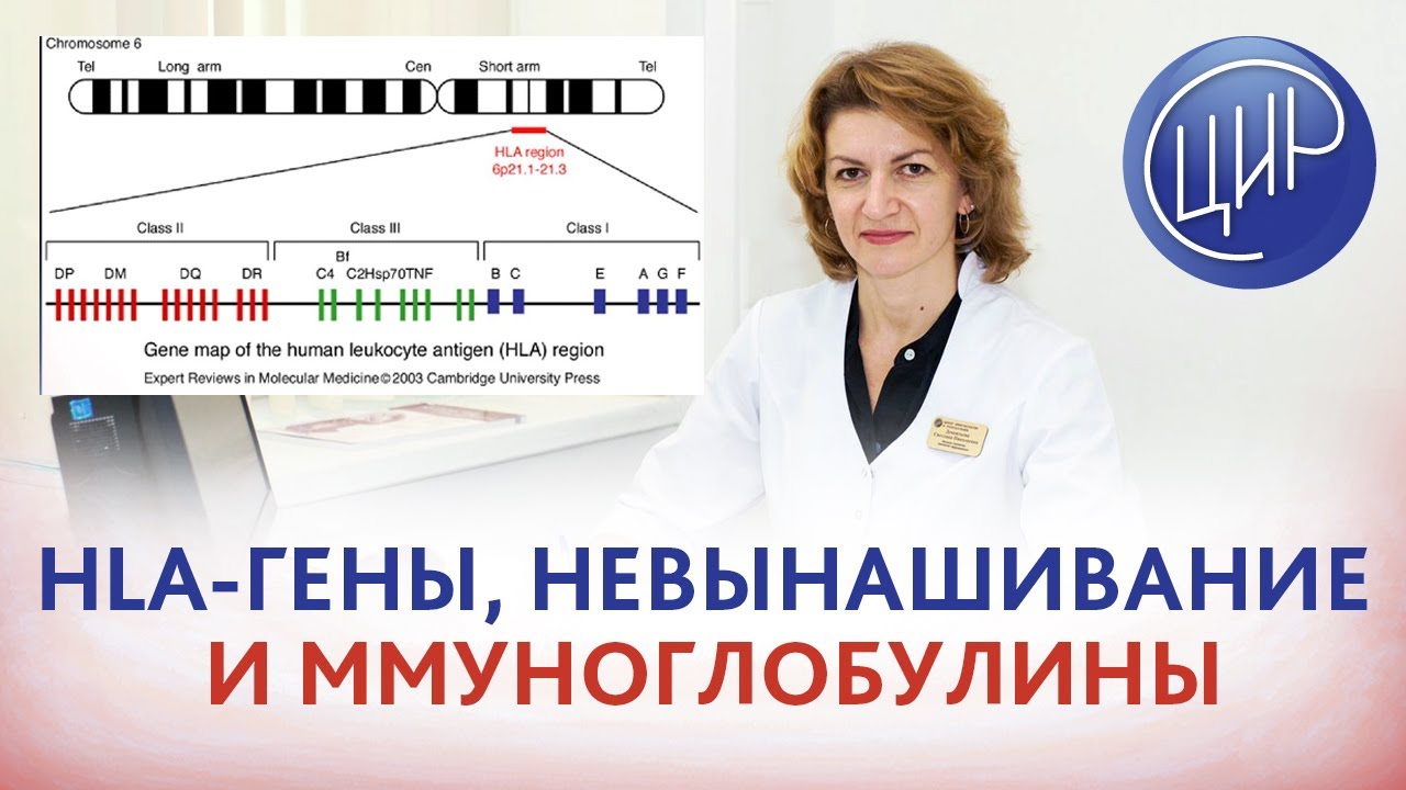 HLA-гены, гемохроматоз, наследование и применение иммуноглобулинов при бесплодии и невынашивании.