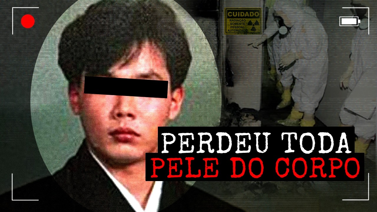 Ele Sofreu o Pior Acidente Nuclear Da História