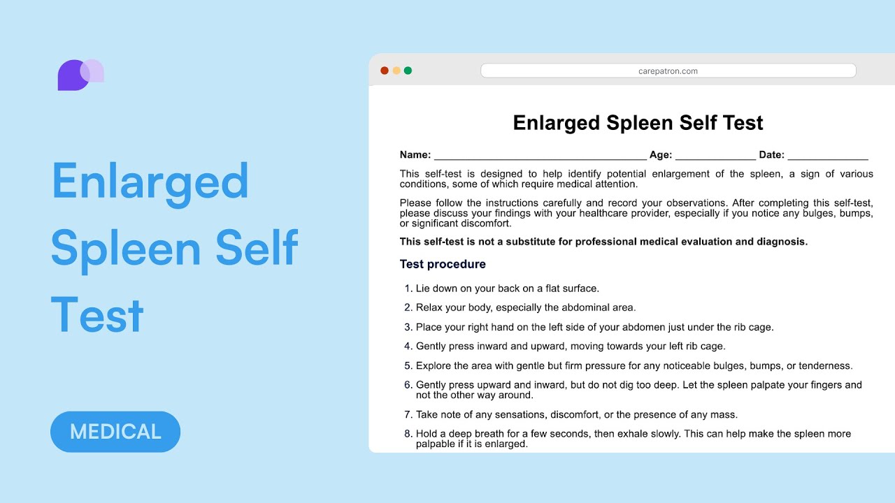 Enlarged Spleen Self Test