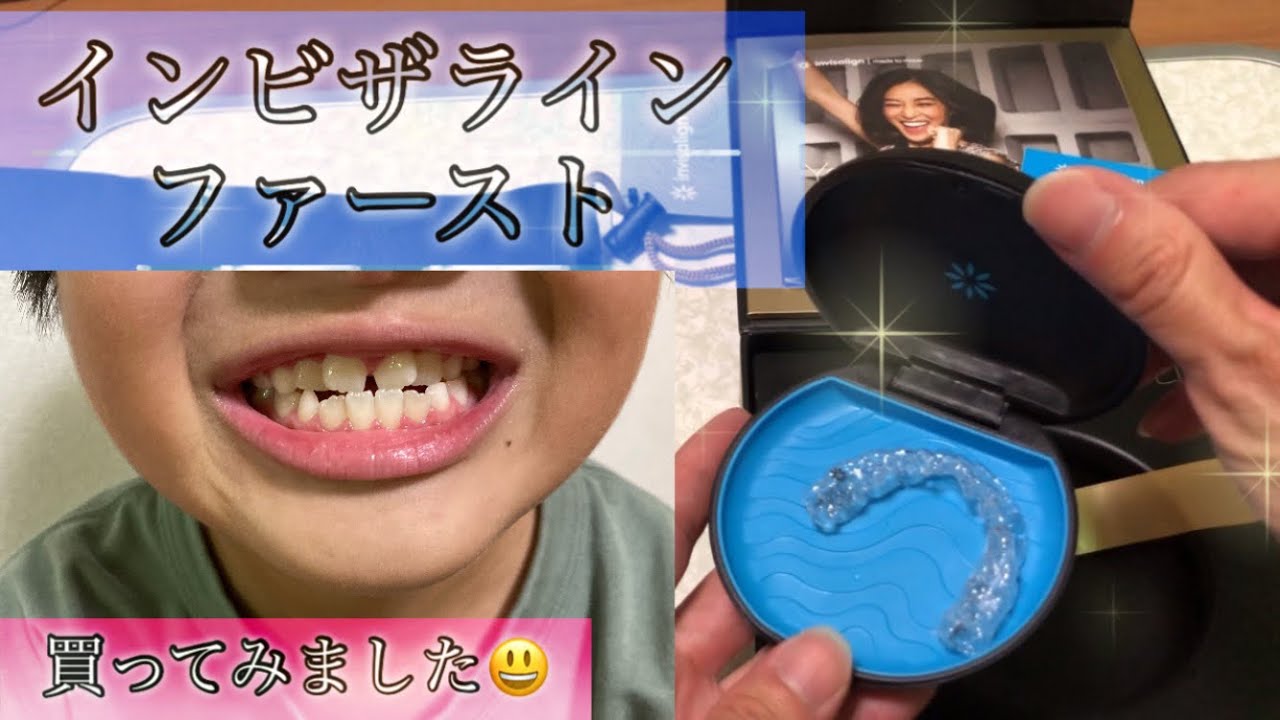 【インビザラインファースト】装着しました😃【小児歯列矯正】36万円