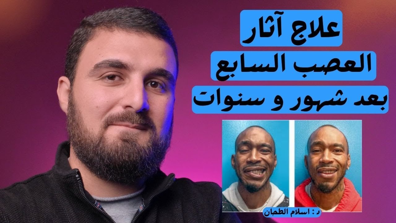لا تيأس! علاج اثار العصب السابع بعد شهور وسنوات { العيادة اليدوية } Synkinesis Treatment