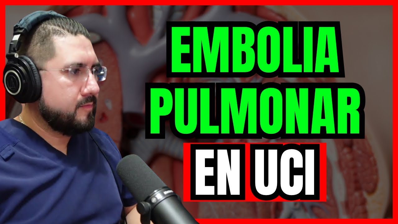 Trombo Embolia Pulmonar y Ventilacion Mecánica: Claves para el Manejo Crítico 🫀🫁🚨
