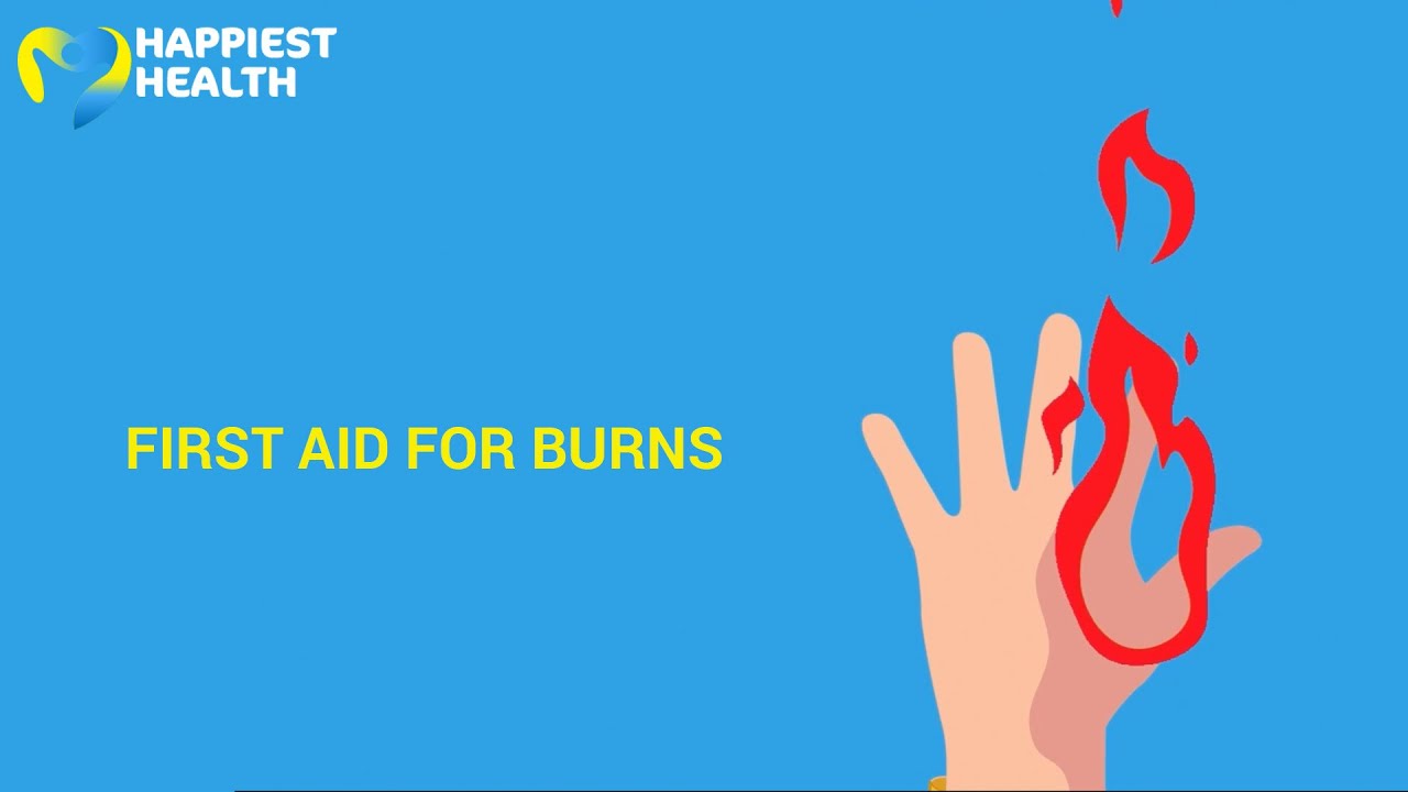 How to do first aid for burns