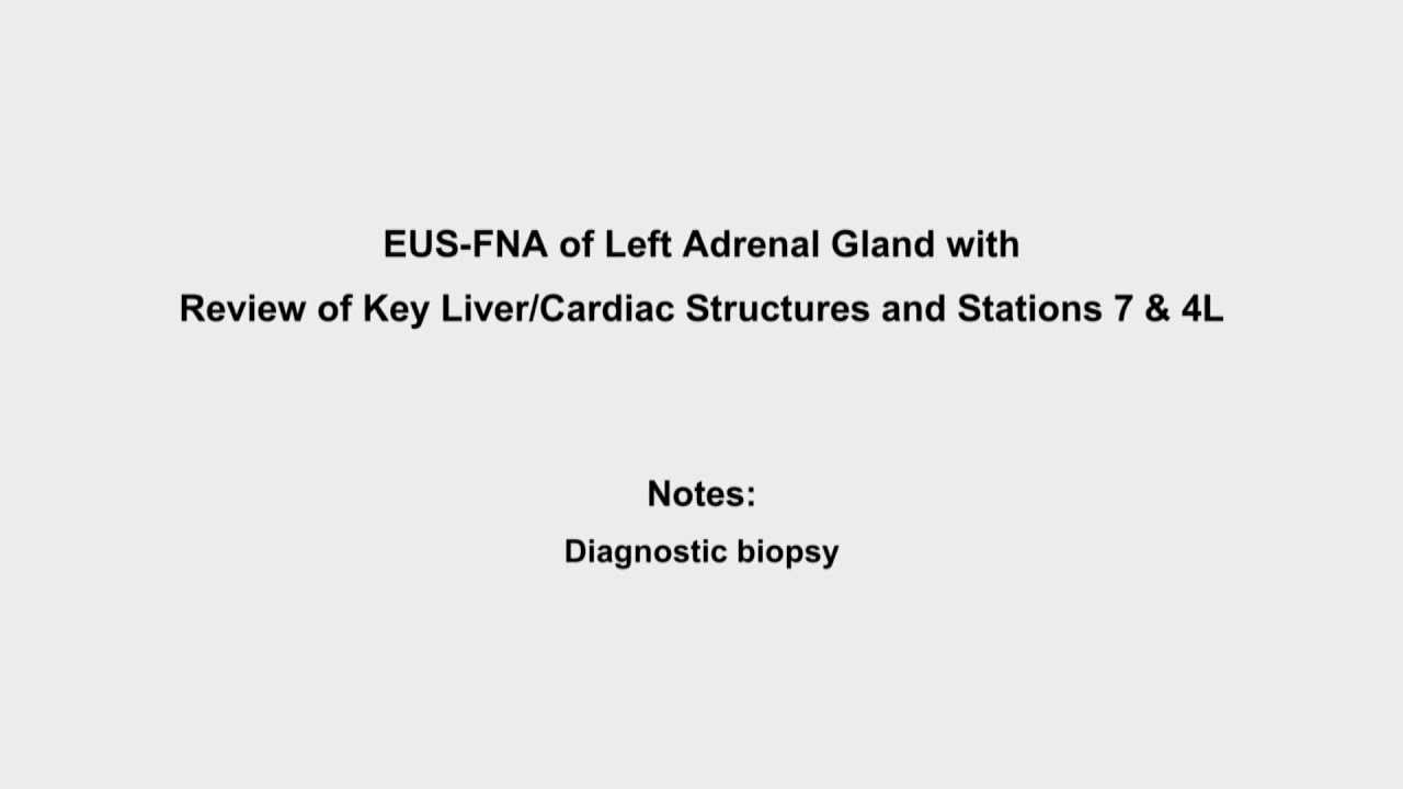 EBUS training video - EUS-FNA of left adrenal gland with review of key liver/cardiac structures