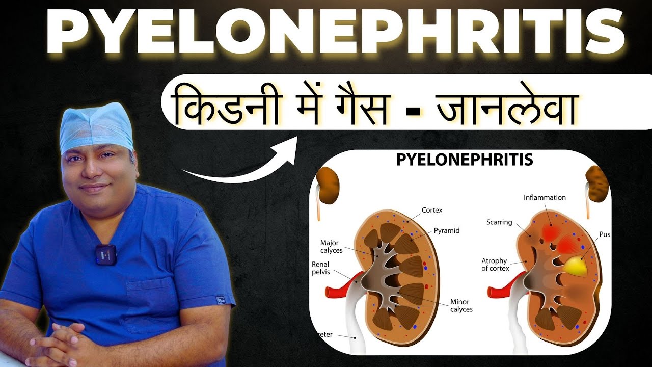 किडनी में गैस – पाइलोनेफ्राइटिस एक जानलेवा इन्फेक्शन ? | Kidney Infection Pyelonephritis