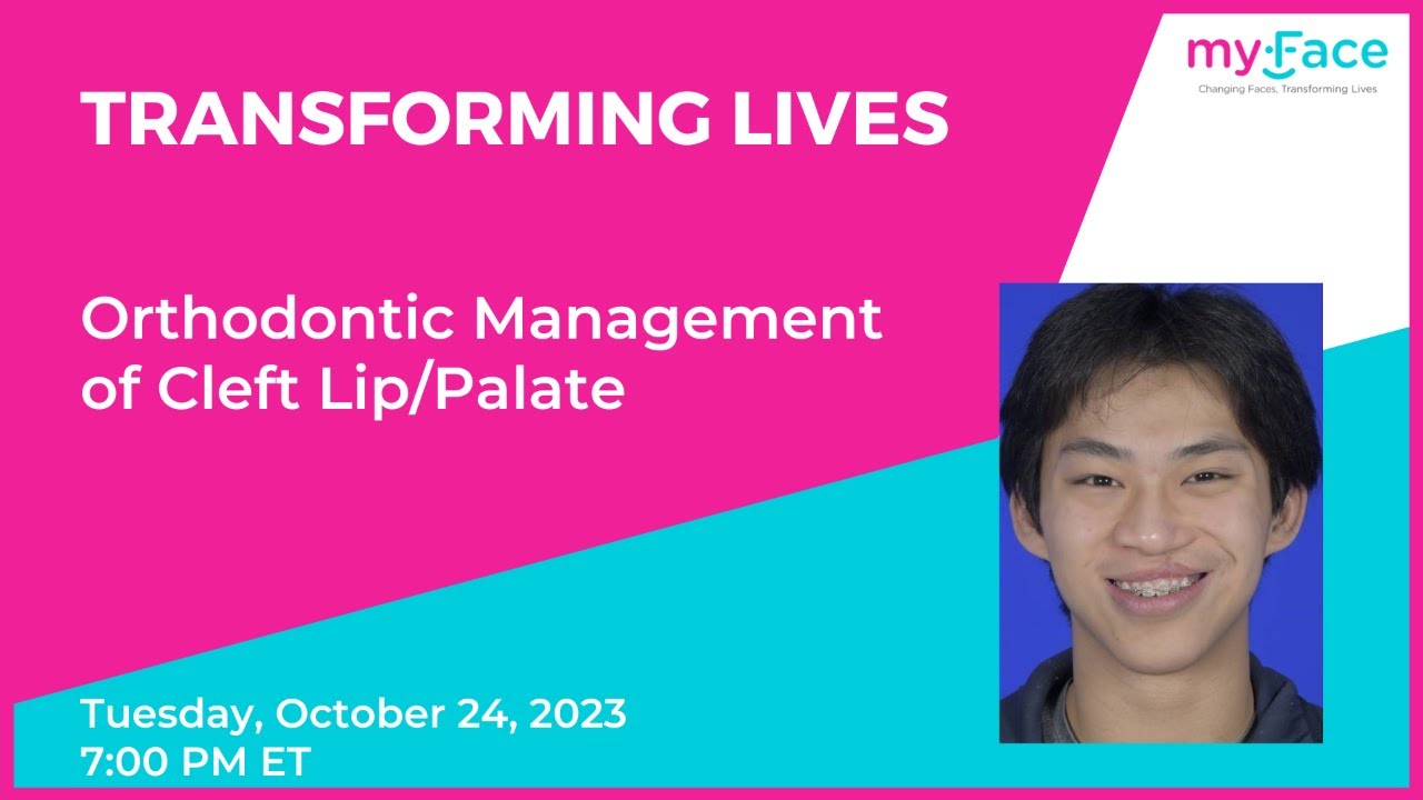 Transforming Lives: Orthodontic Management of Cleft Lip/Palate