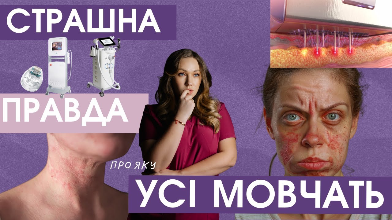 RF ліфтинг обличчя - розвіюю популярні міфи: зварює твою шкіру, залишає рубці і шрами.