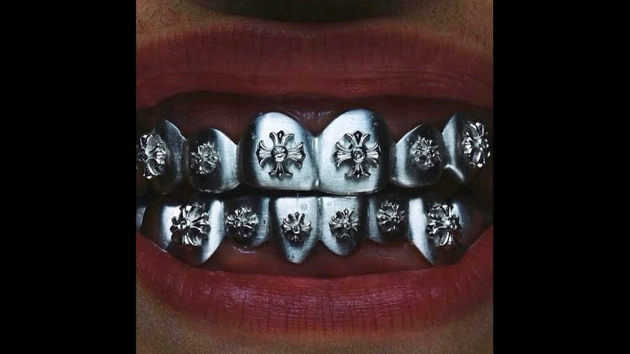[FREE] Melodic Type Beat - "MY KISS" | Trap Instrumental 2024