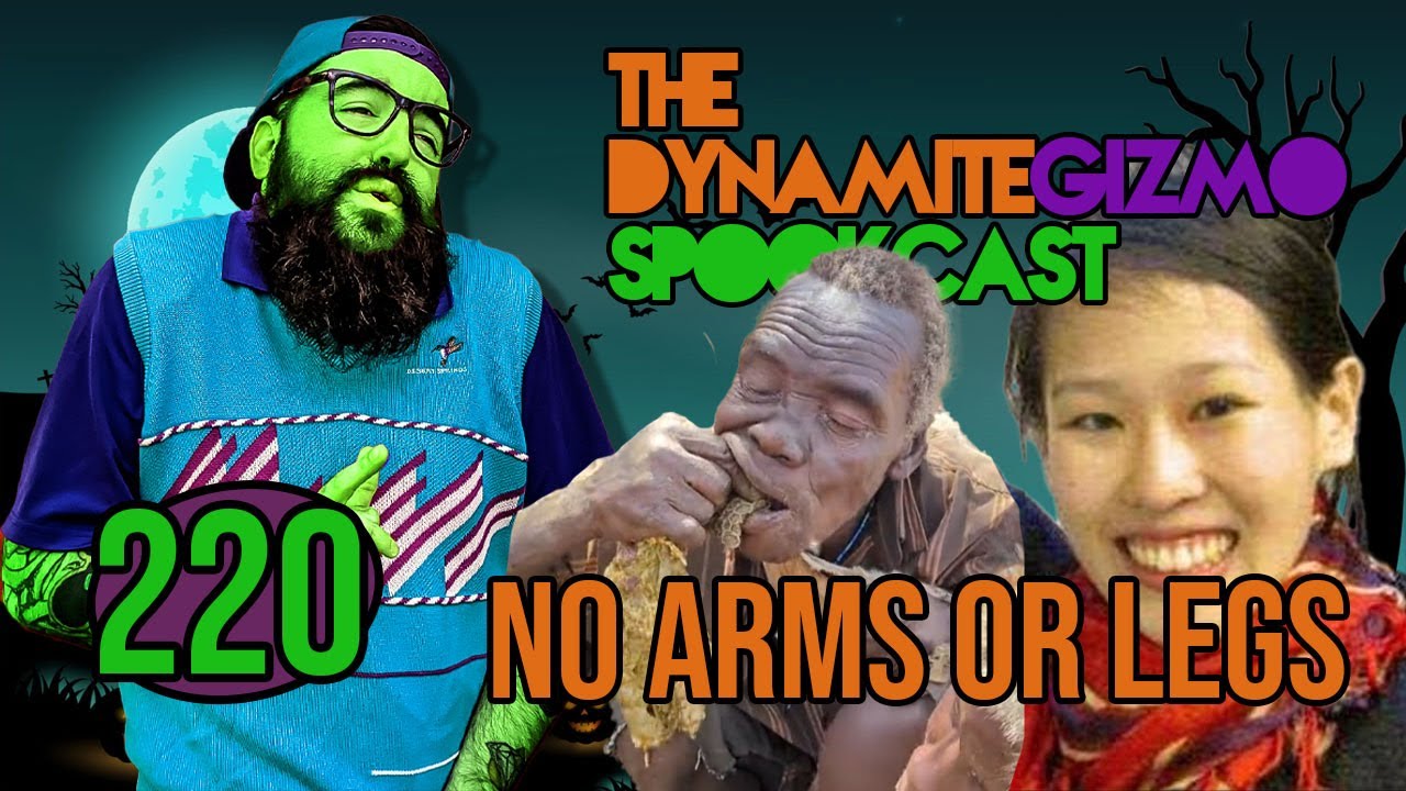No Arms or Legs - The DynamiteGizmo Podcast Ep.220