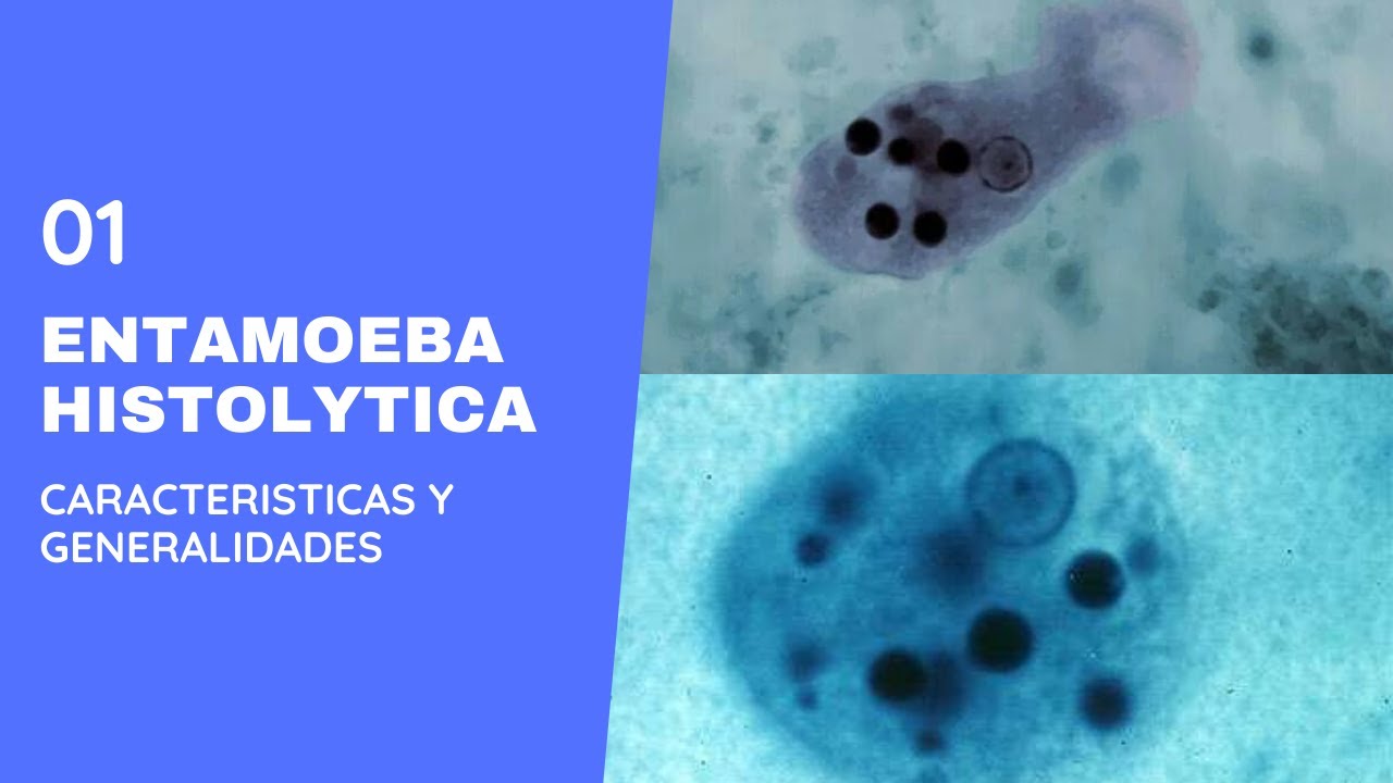 Entamoeba histolytica