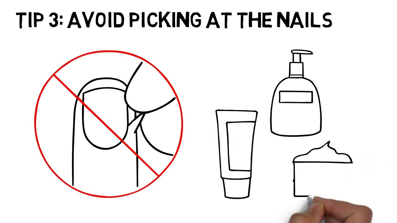 Nail Care for Children Taking Targeted Therapies