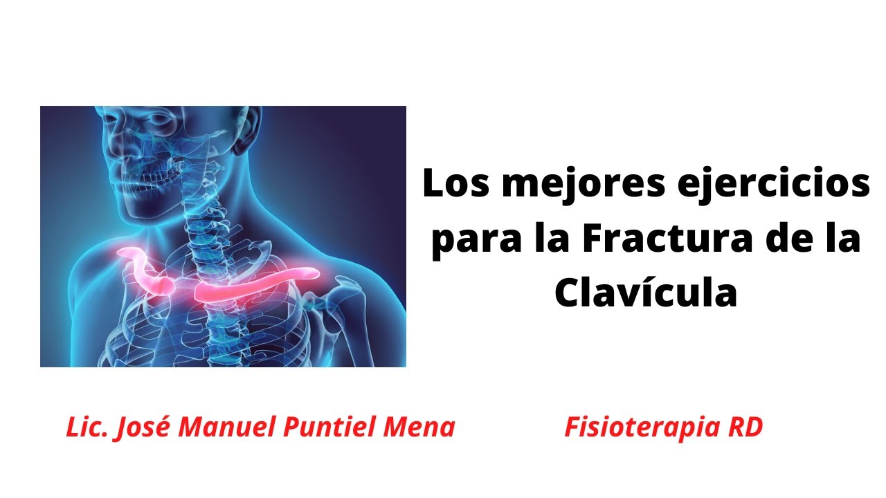 Los mejores ejercicios para la Fractura de la Clavicula - FisioterapiaRD