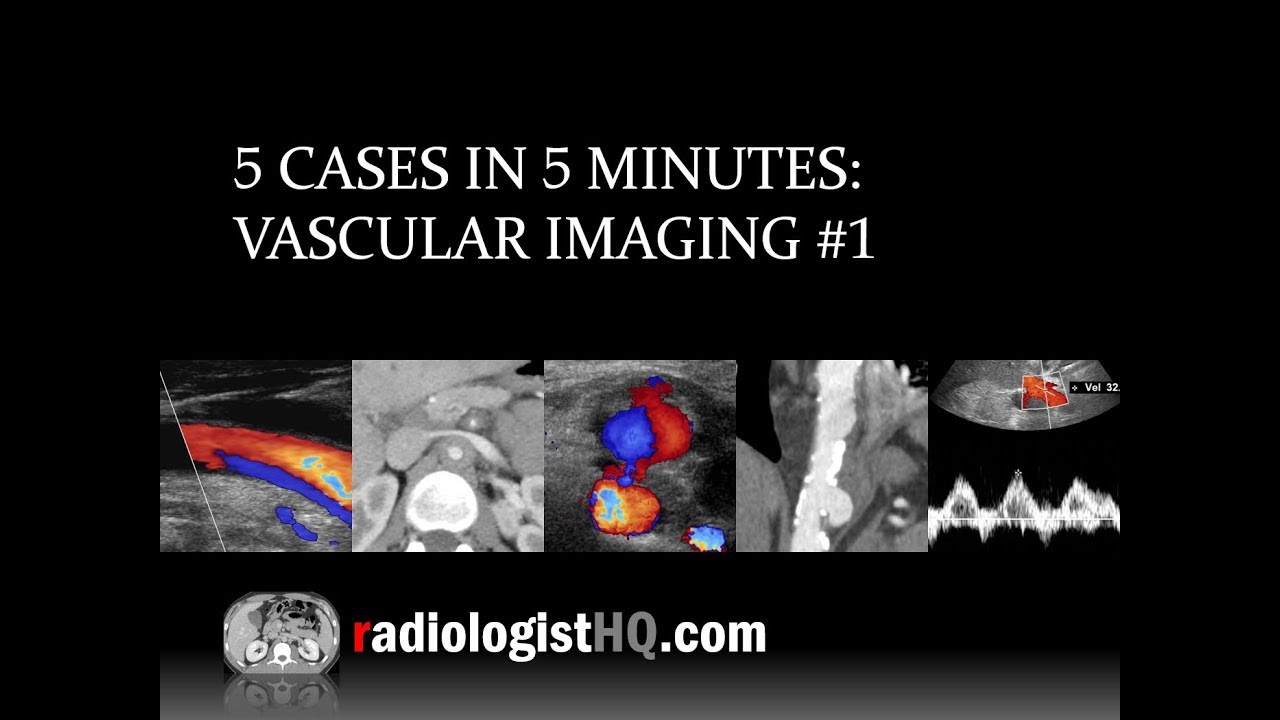 5 Cases in 5 Minutes: Vascular #1