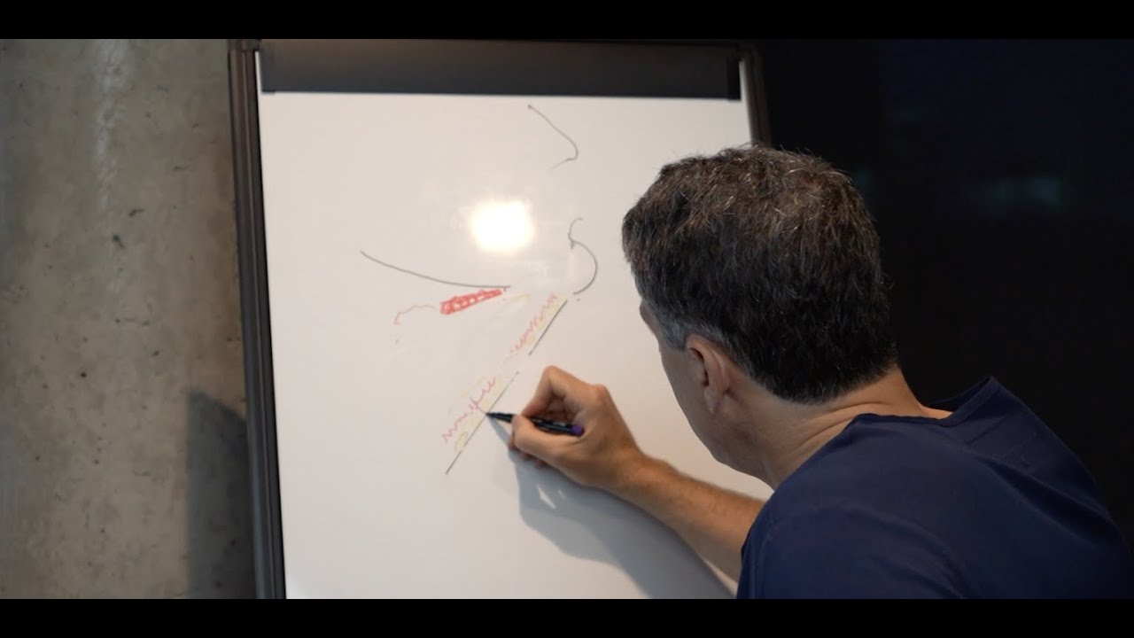 Different Types of Neck Lift - Part 2 | 8 West Clinic - Vancouver, BC