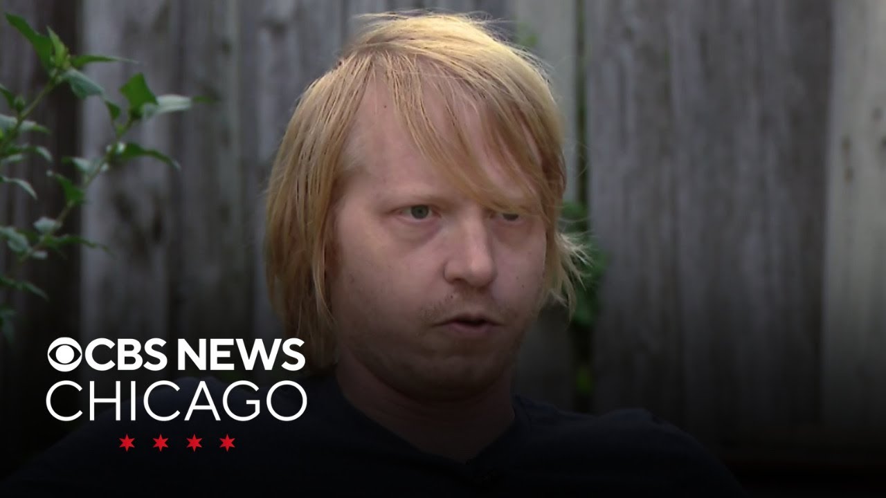 Man speaks out after being shot during armed robbery in Chicago's Avondale neighborhood