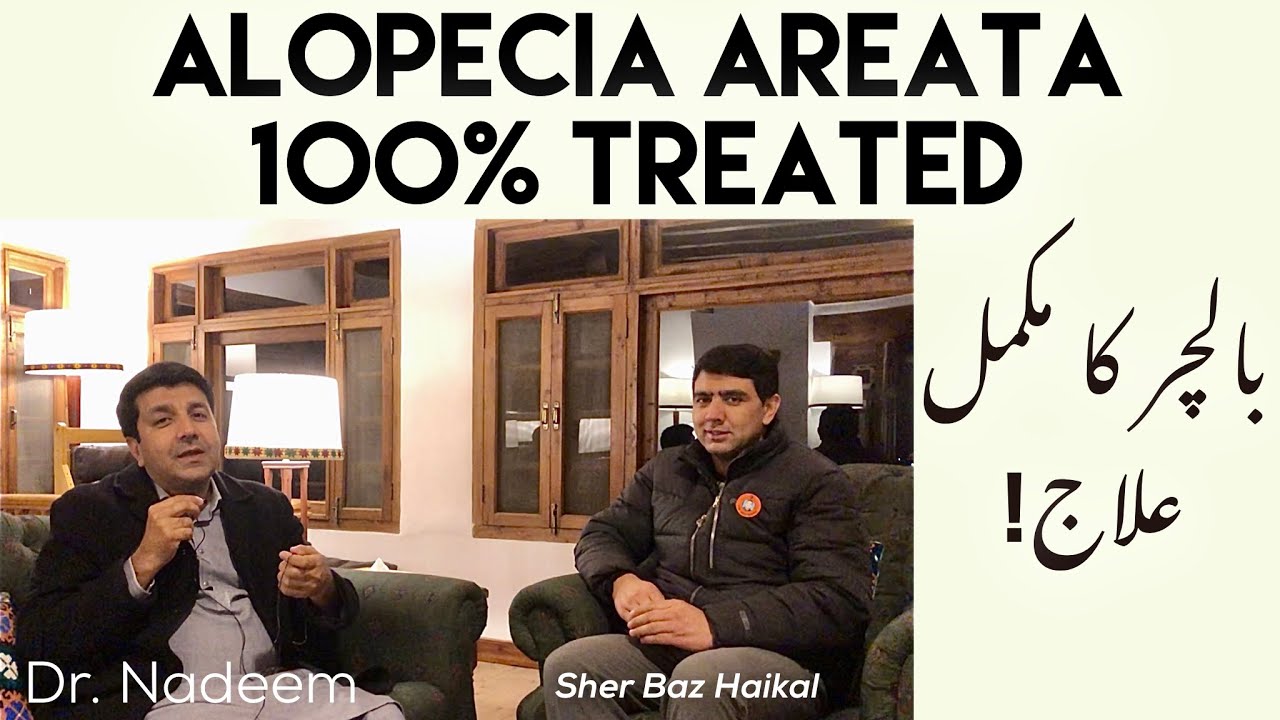 Baalchar Ka Aik Kamyab ilaaj/ Alopecia Areata Patient Treated 100% - Dr. Nadeem Sarwar ft. Sher Baz