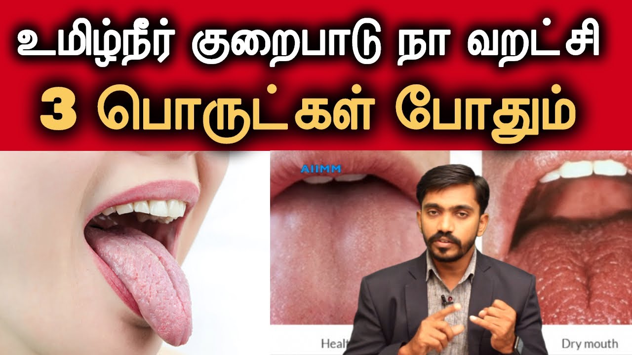 வாய் வறட்சி DRY MOUTH, வாய் துர்நாற்றம்?? அருமையான தீர்வு!! | DrSJ