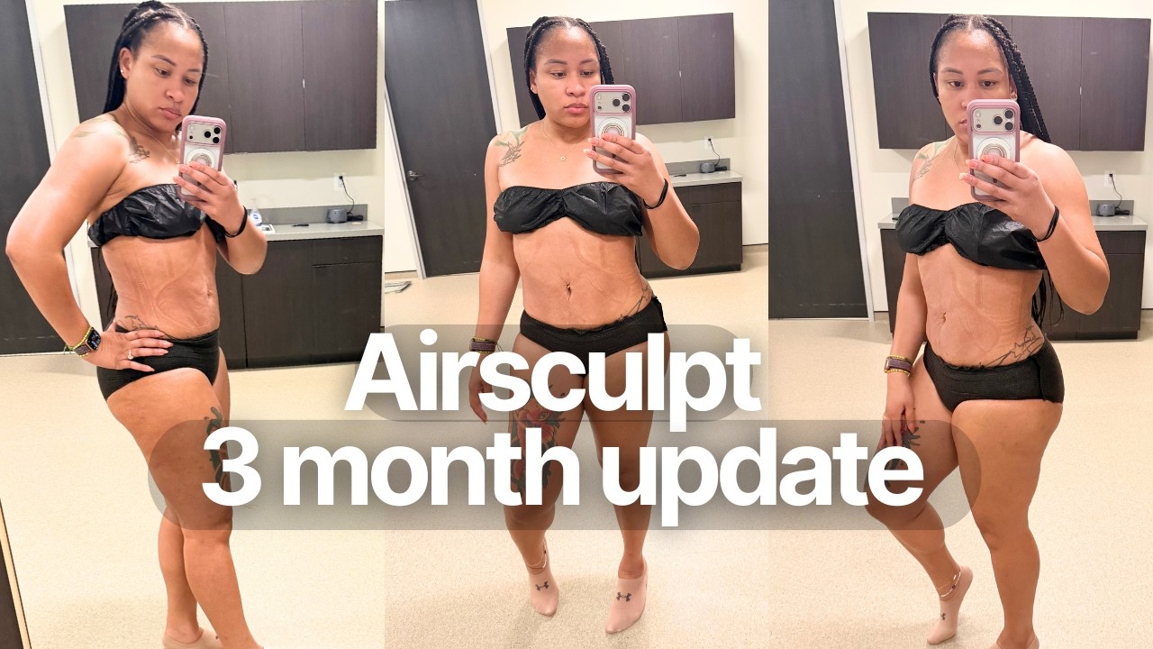 My Honest Thoughts: Recovery, Breast Fat Transfer Results + Compression