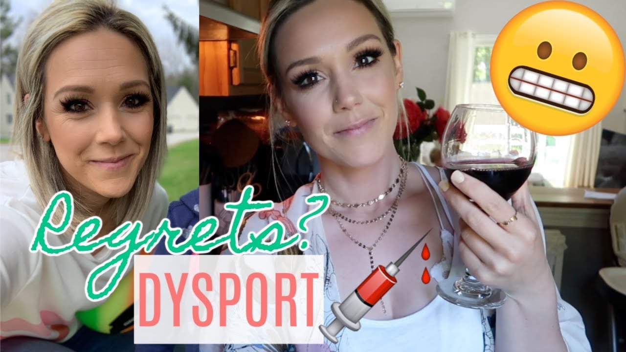 I GOT DYSPORT/BOTOX! REGRETS?| Before and After Results| Tres Chic Mama