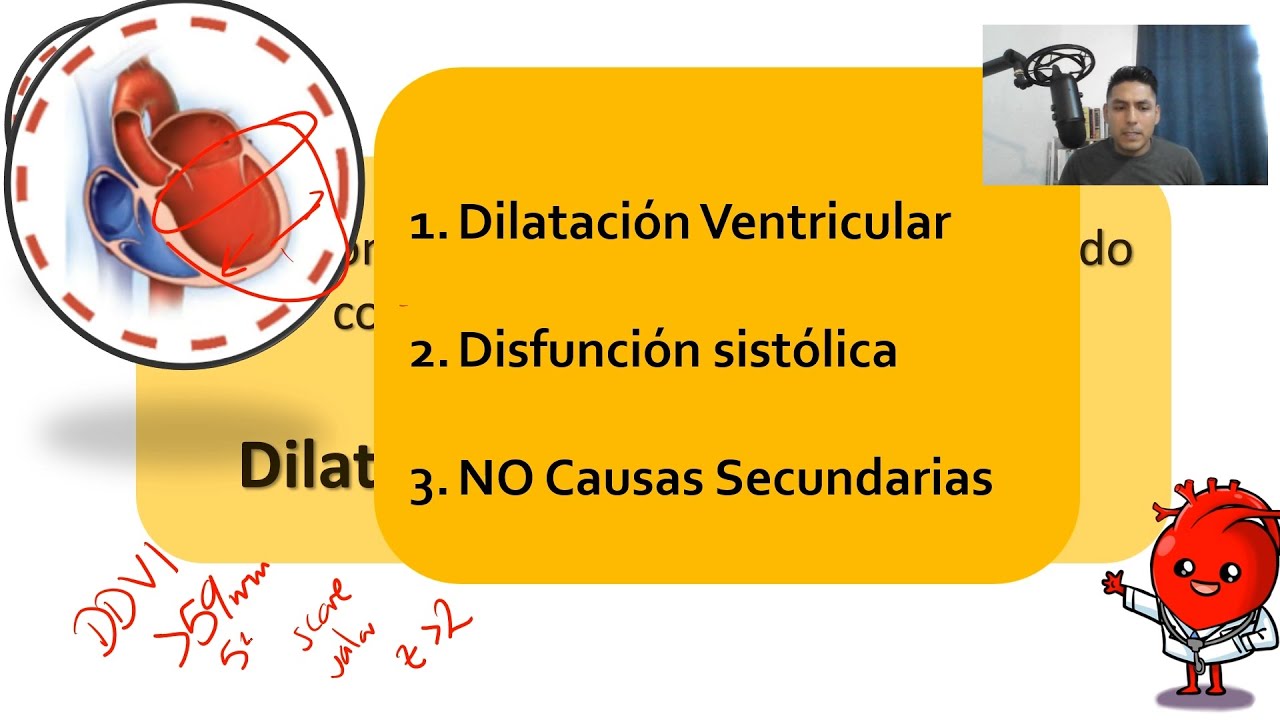 MIOcardiopatía dilatada | Cardiomiopatía
