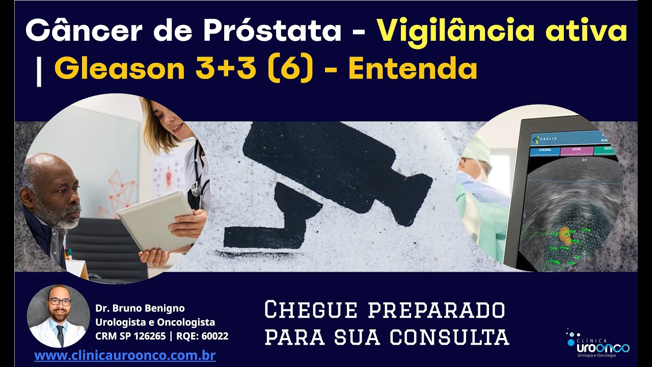 Câncer de Próstata Gleason 6: Tratar Agora ou Esperar? Os desafios da Vigilância Ativa