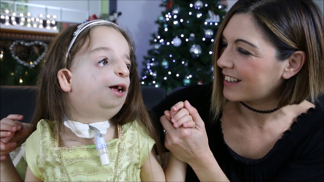 Abi's Life with Treacher Collins (Finding a Voice)