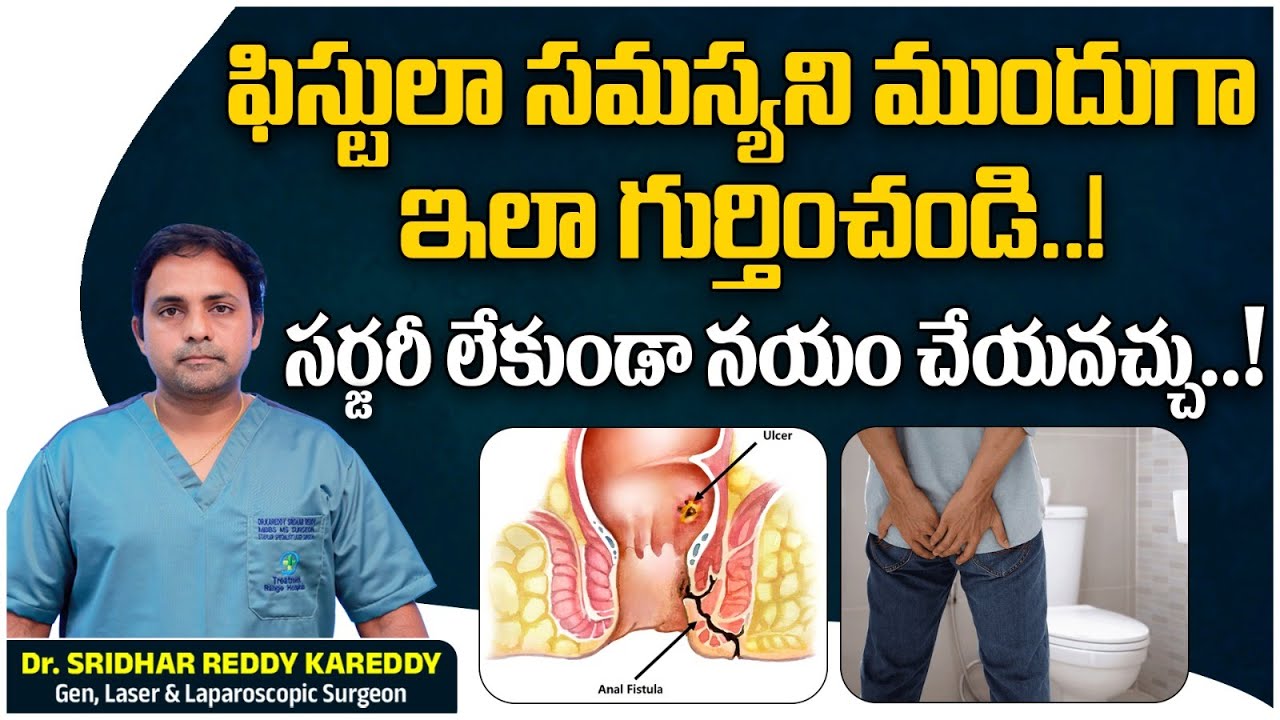 Fistula Causes Symptoms and Treatment || How to Cure Fistula in Telugu || Treatment Range Hospital