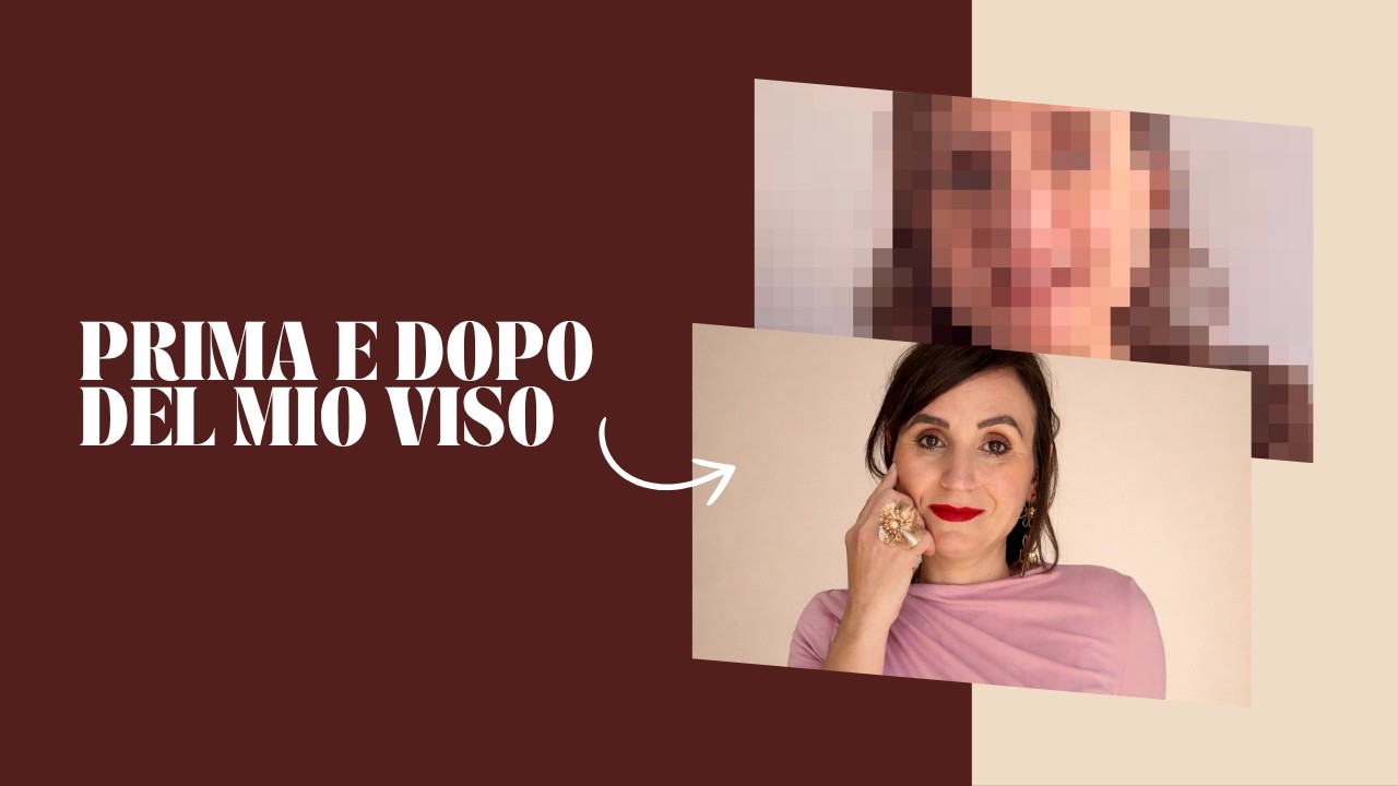 FORMA DEL VISO: SICURA CHE BASTI?