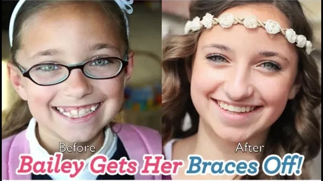 Bailey Gets Her Braces Off!