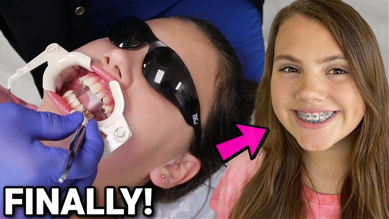 Gracelynn Gets Braces! FINALLY!