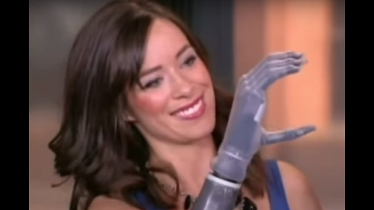 NY Fashion Week Runway Model See Bionic Arm as the Ultimate Tech Accessory