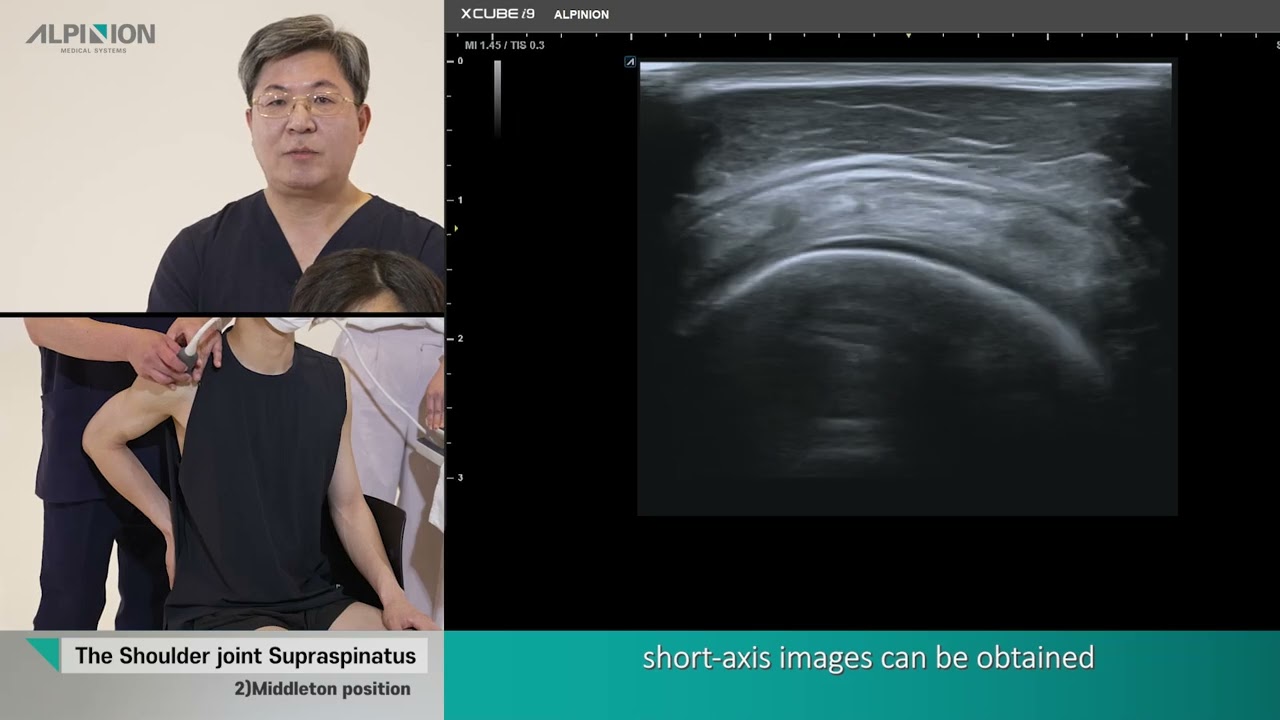 Musculoskeletal Ultrasound (Shoulder) 04.Supraspinatus