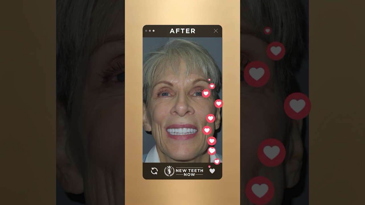 Full mouth dental implants have not only transformed her smile but also her quality of life.