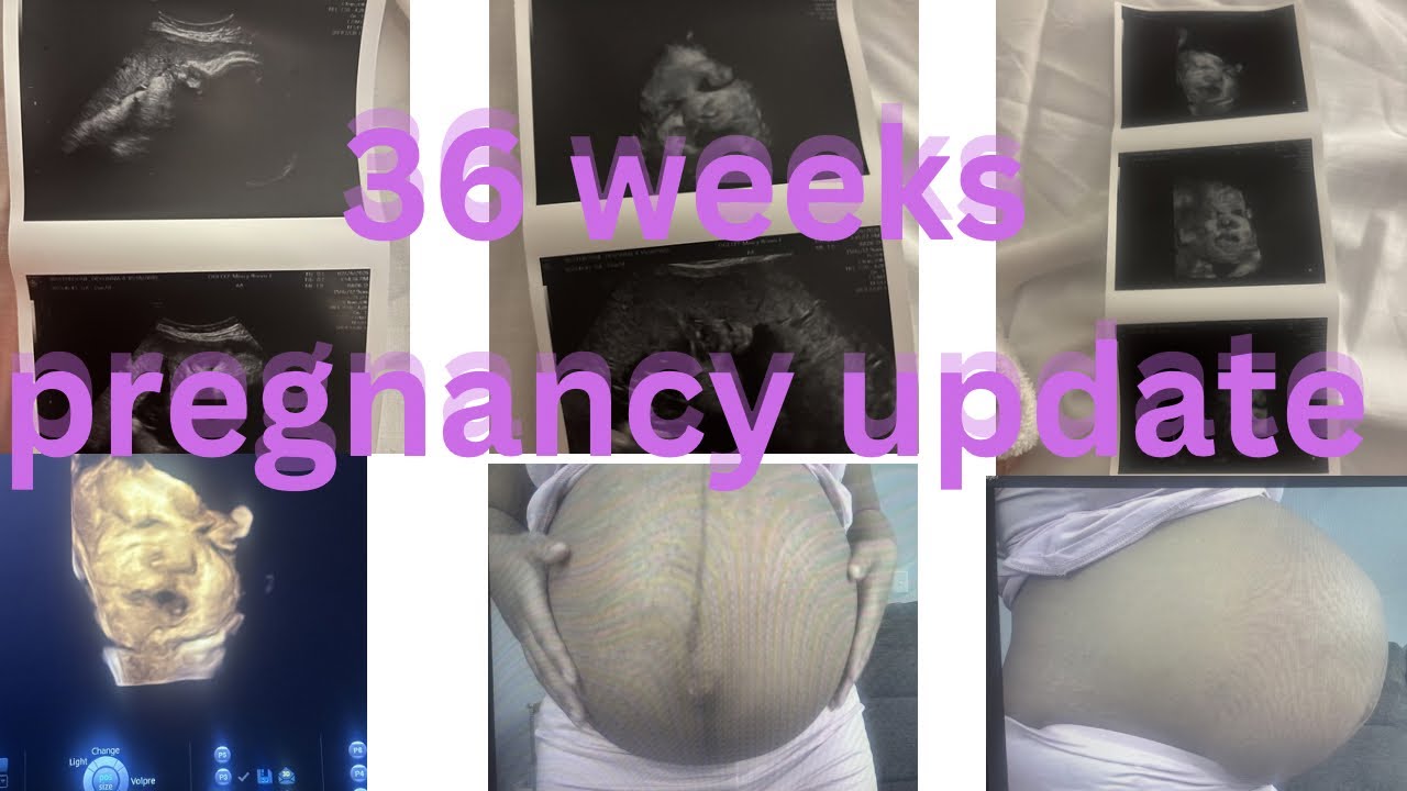36 week pregnancy update