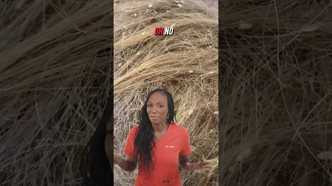 Oh No! Lice! #lice #nits #licetreatment #dr_bayo #dr_bcw #healthtips