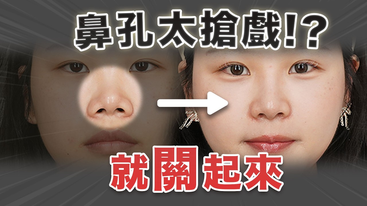 2025最新版！不只延長鼻頭？露鼻孔終極奧義！首次公開說明｜依心唯美 謝東穎醫師