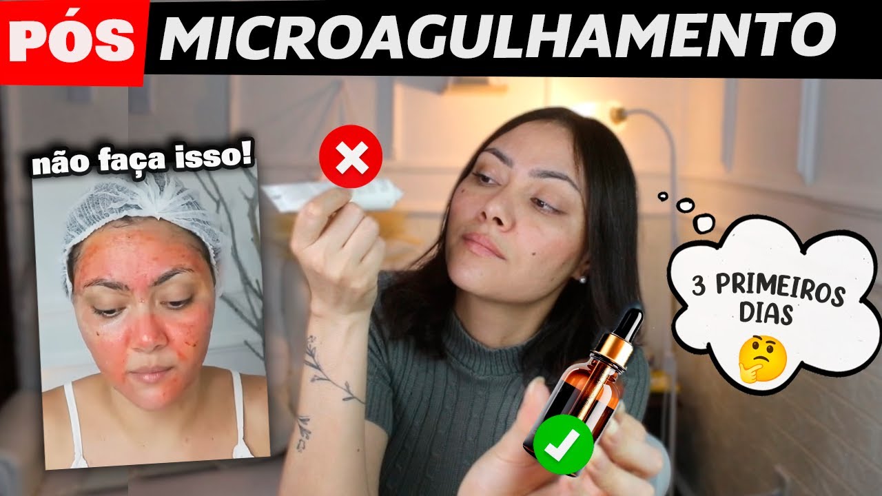 PÓS-MICROAGULHAMENTO: FAÇA ISSO NOS 3 PRIMEIROS DIAS! 😱💥 Dicas Reais + Ciência   #microagulhamento