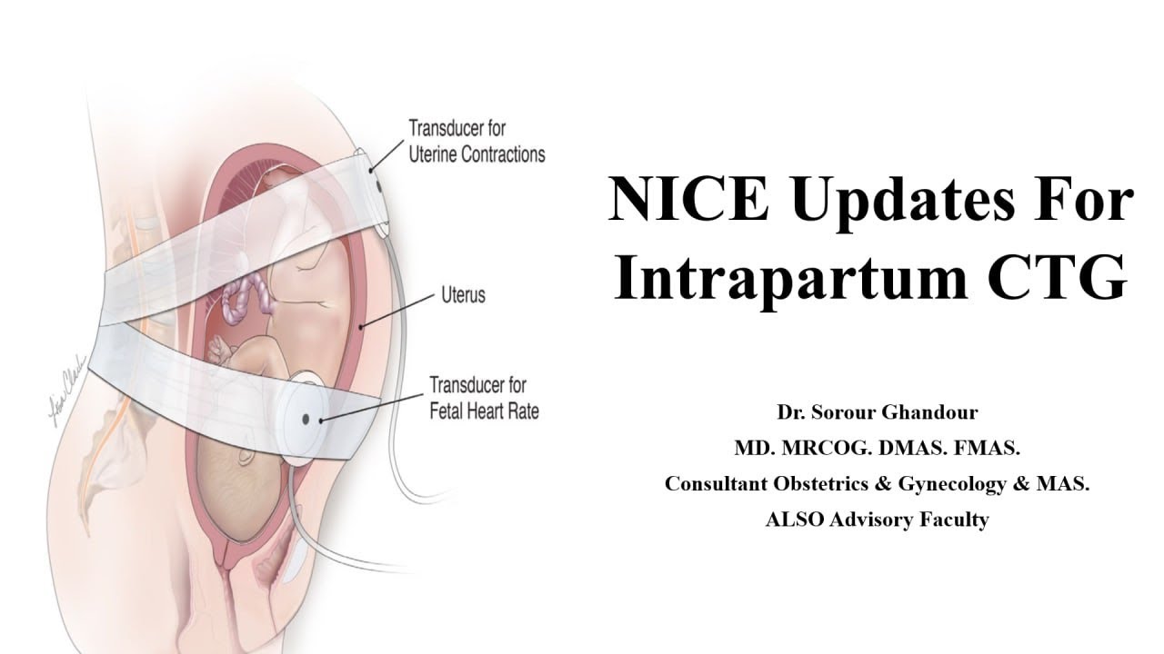CTG NICE Updates - Saving babies life care bundle MRCOG Part 2 & 3