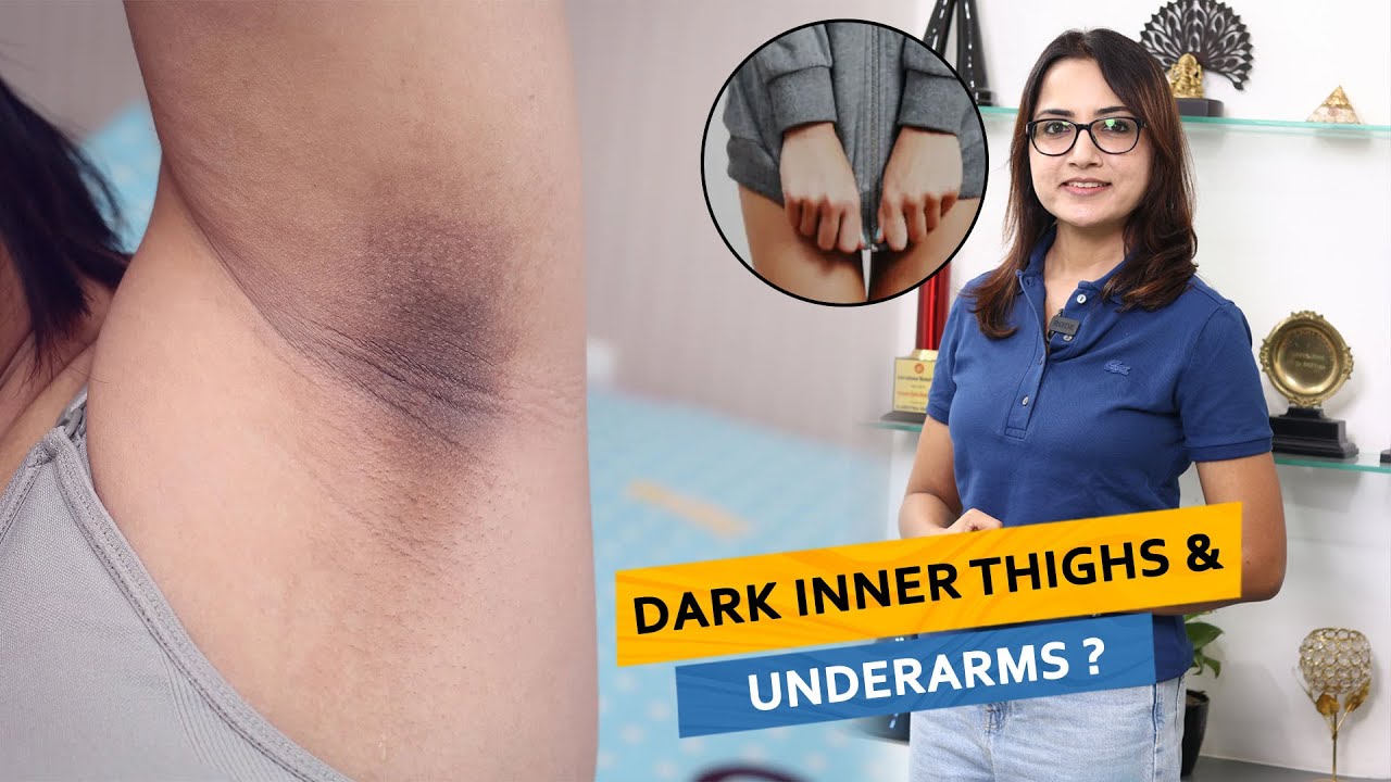 Dark Inner Thighs & Underarms | Dr. Deepika Lunawat