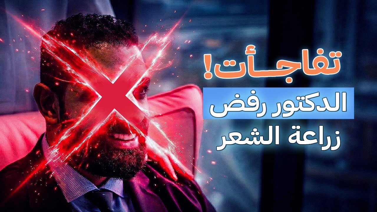 زراعة الشعر للمرة الثانية هل هي الحل؟ تجربة واقعية ونصيحة من الدكتور بلوي