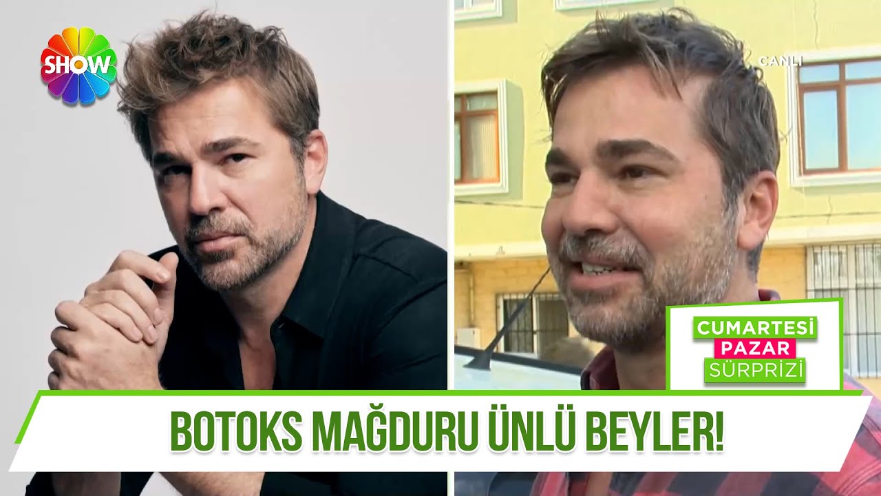 Ünlü erkeklerin botoksla imtihanı!
