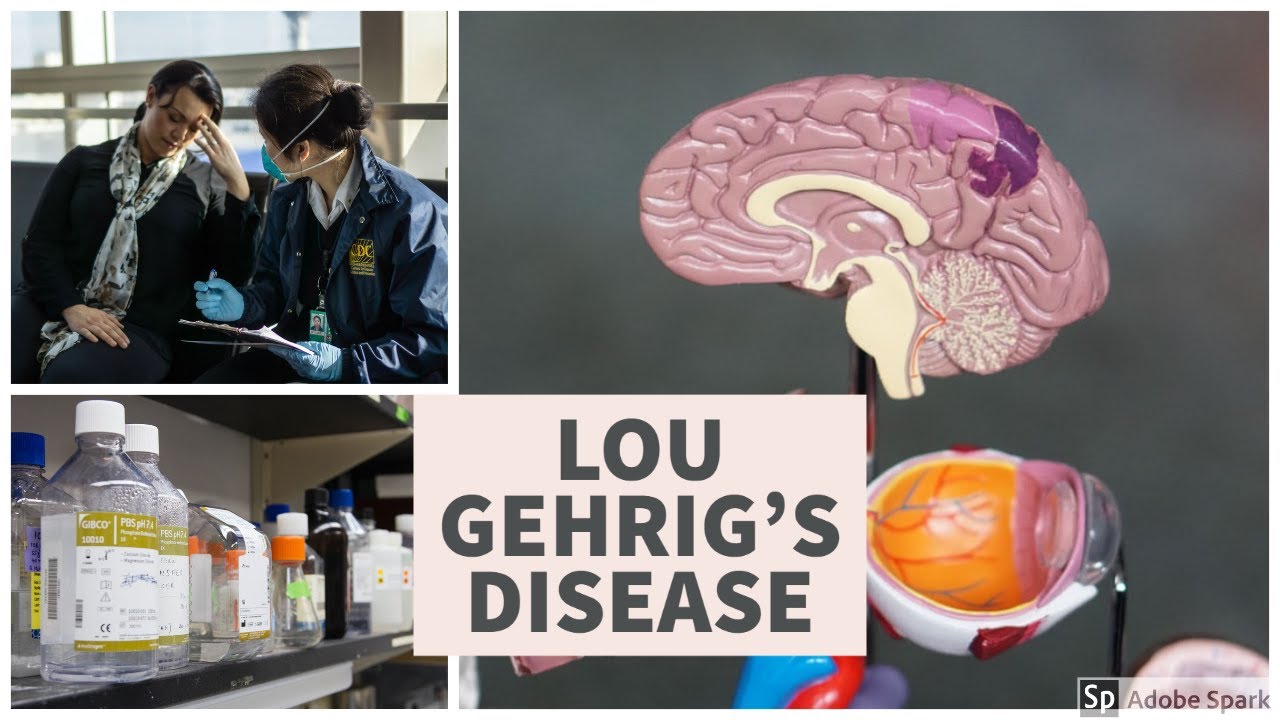what is lou gehrigs disease?