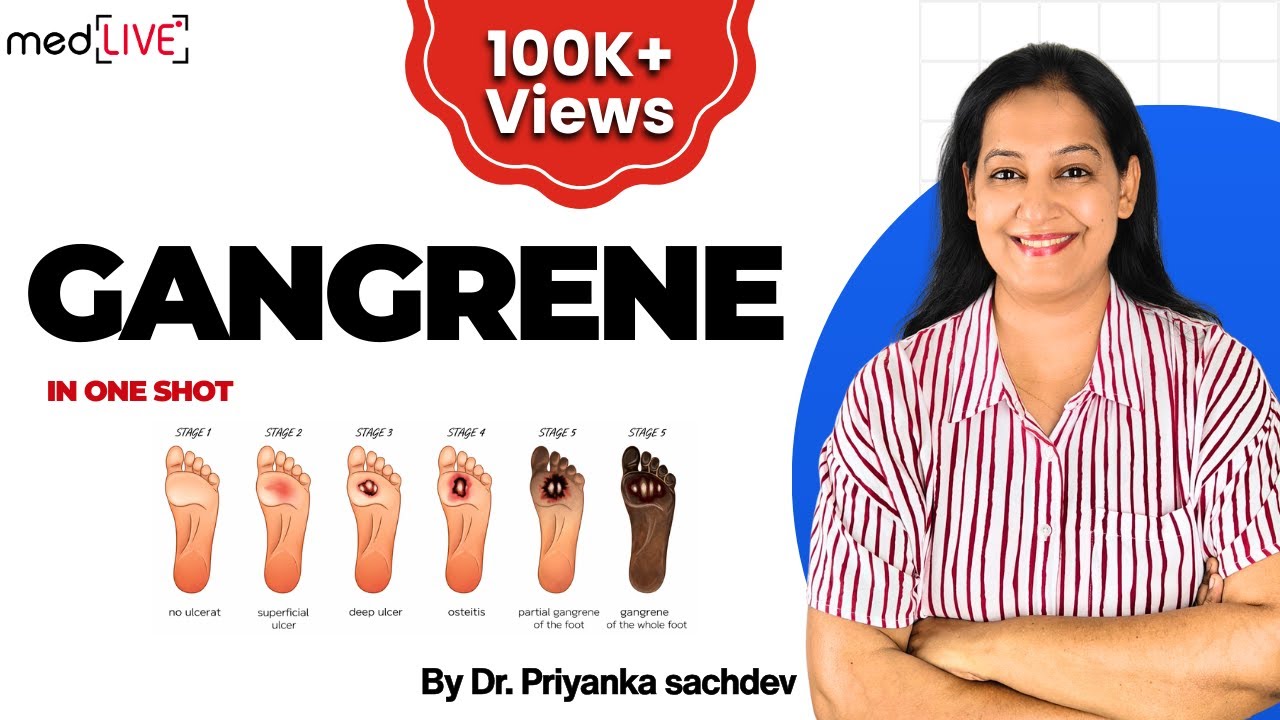 Gangrene Pathology: Dry vs Wet Gangrene & Gas Gangrene | Cell Injury | MBBS