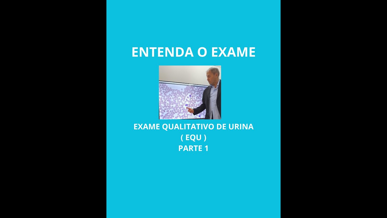 EQU PARTE 1
