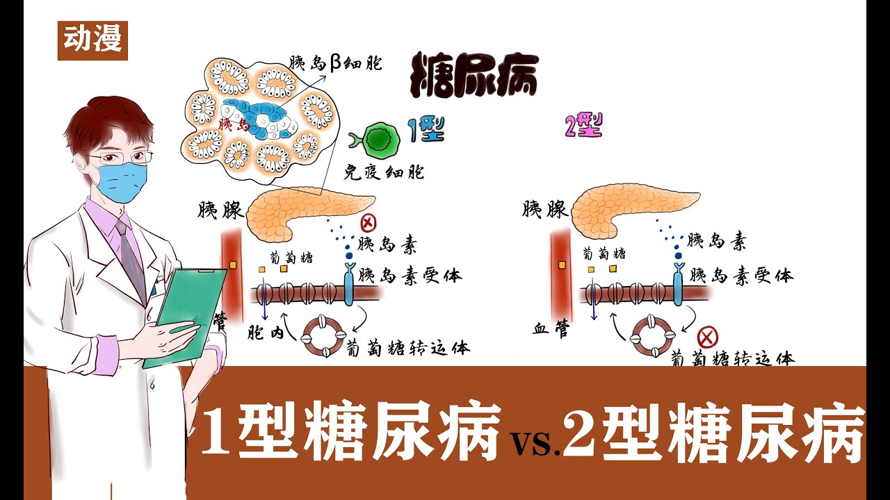医学动漫 | 1型糖尿病 VS.2型糖尿病 Medical  Drawing Animation | Type 1 Diabetes vs. Type 2 Diabetes メディカルアニメーション
