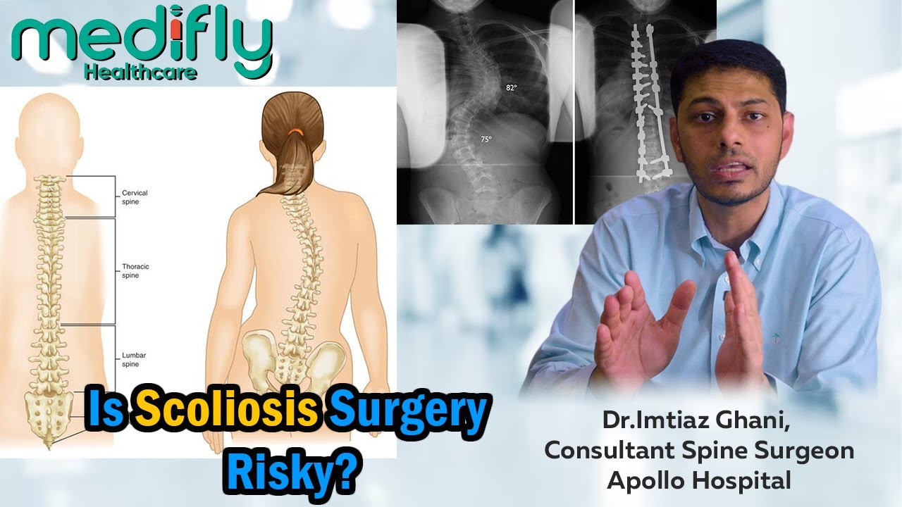 Is Scoliosis Surgery Risky? Dr Imtiaz Ghani