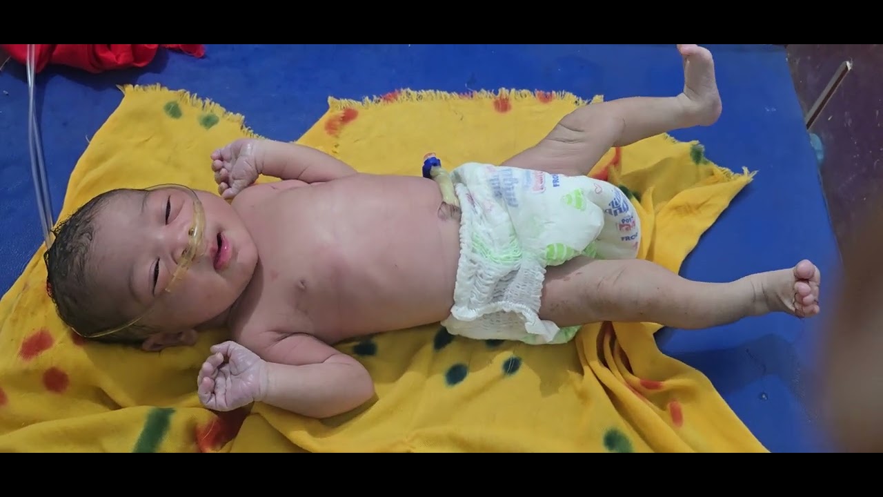 Show sweet baby girl in my hospital🥰🥰