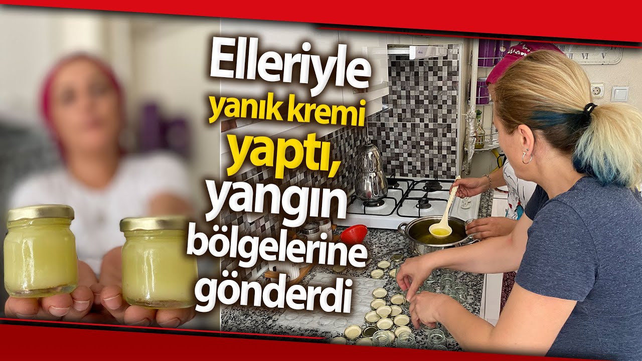 Hayvanlar ve İnsanlar İçin Sadece 3 Malzemeyle Yanık Kremi Yaptı